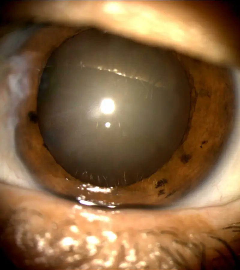oftamologia (7)