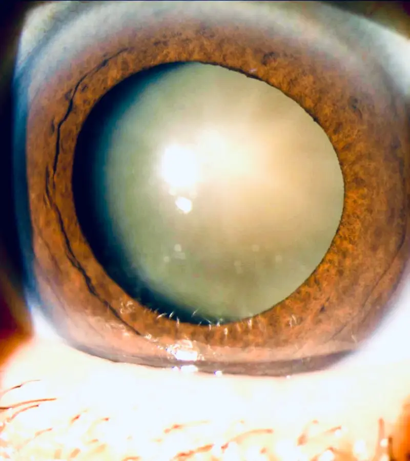 oftamologia (9)
